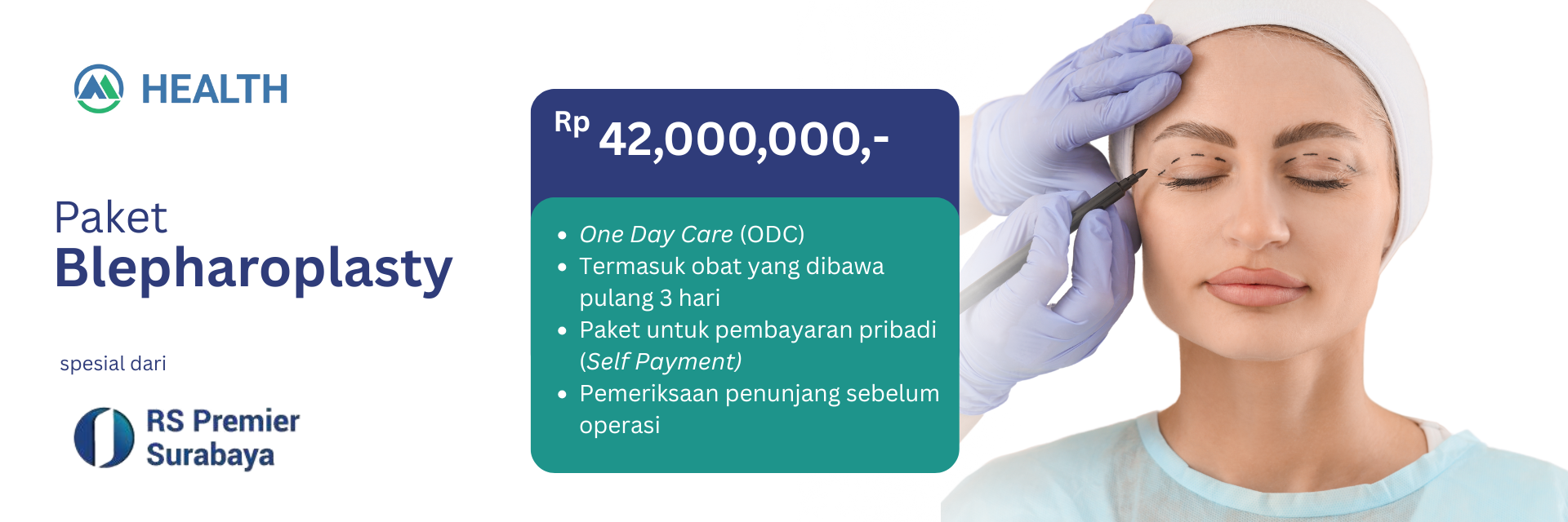 Paket Blepharoplasty (Operasi Kelopak) by RS Premier Surabaya
