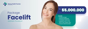 facelift