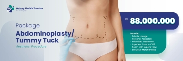 abdominoplasty-tummy-tuck